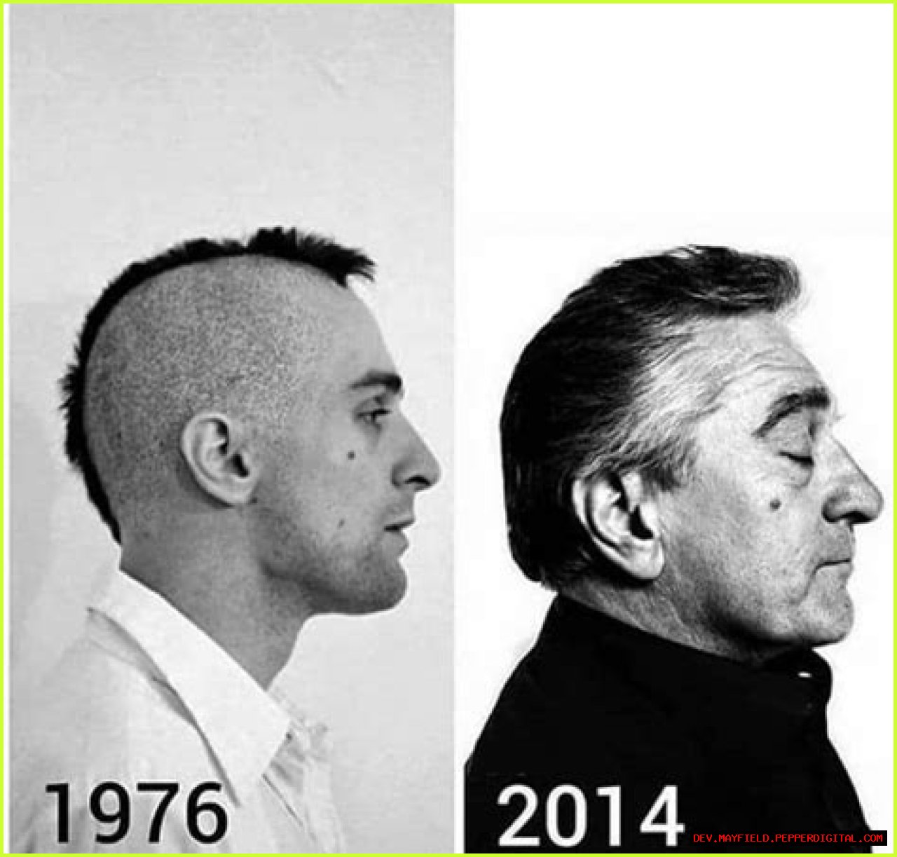 Understanding The De Niro Ear: A Comprehensive Guide