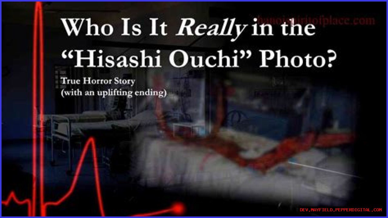 Unraveling The Mystery Of Hisashi Ouchi's Real Body